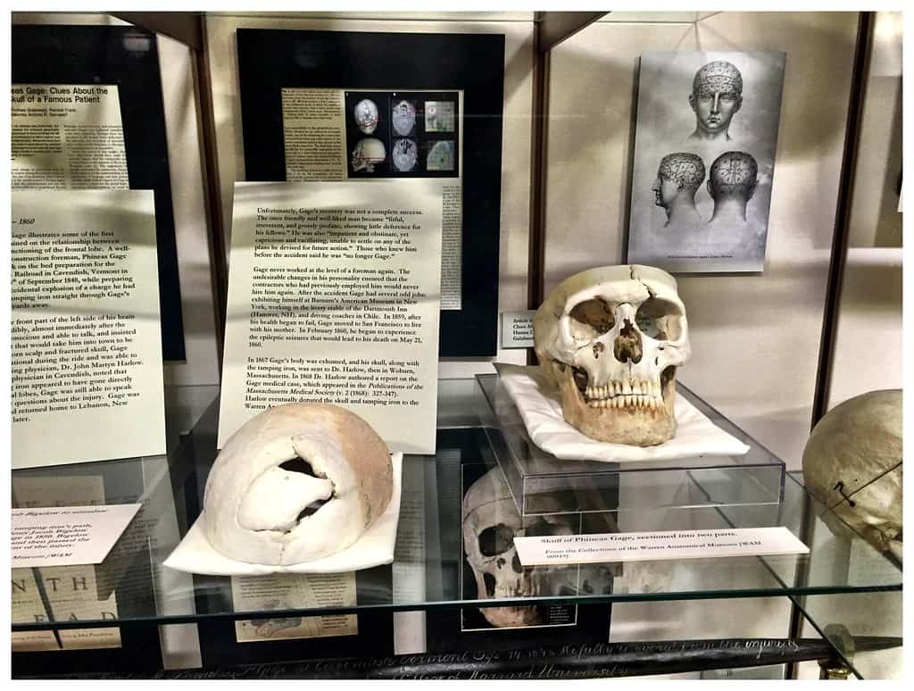 Museo de Anatomía Warren